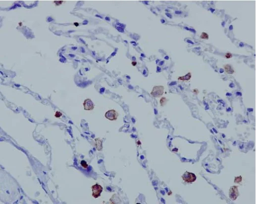 Immunohistochemistry (Formalin/PFA-fixed paraffin-embedded sections) - Anti-MCEMP1 antibody [EPR14393] - C-terminal (AB188572)