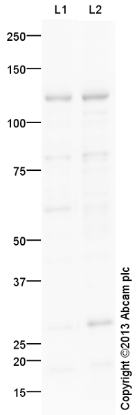 Western blot - MCF7 nuclear extract lysate (AB14860)