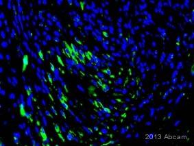 Anti-mCherry 抗体 [1C51] (ab125096) | Abcam