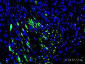Immunohistochemistry (Formalin/PFA-fixed paraffin-embedded sections) - Anti-mCherry antibody [1C51] (AB125096)