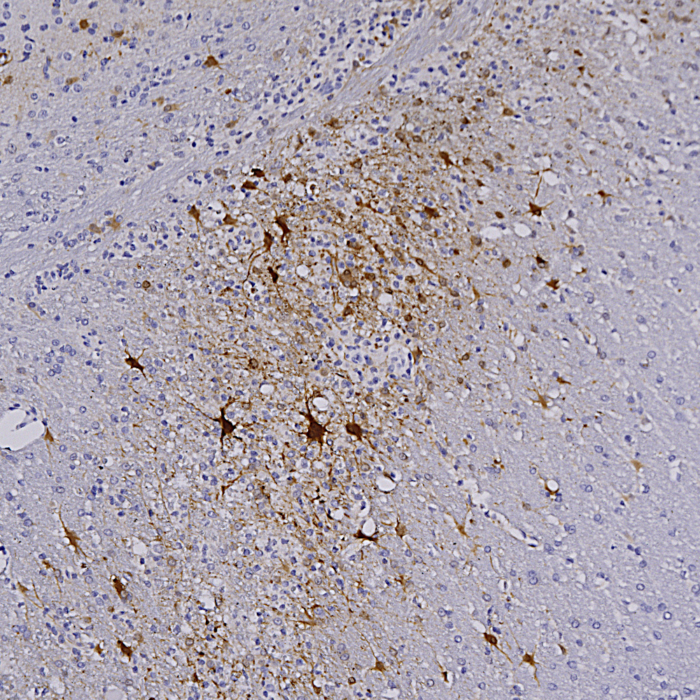 Immunohistochemistry (Formalin/PFA-fixed paraffin-embedded sections) - Anti-mCherry antibody [1C51] (AB125096)