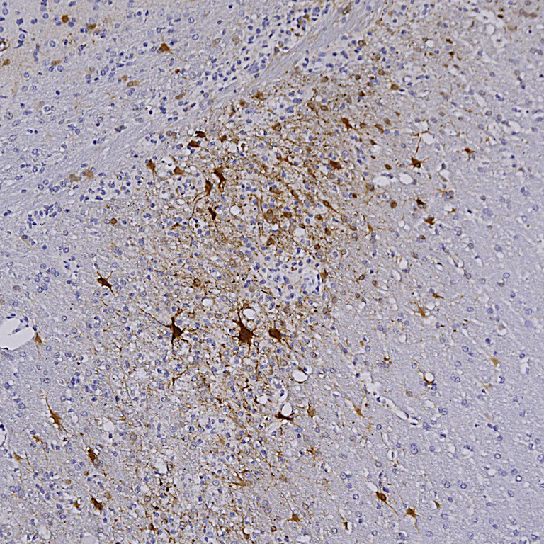 Immunohistochemistry (Formalin/PFA-fixed paraffin-embedded sections) - Anti-mCherry antibody [1C51] (AB125096)