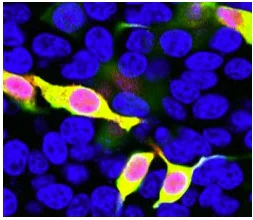 Immunocytochemistry/ Immunofluorescence - Anti-mCherry antibody (AB167453)