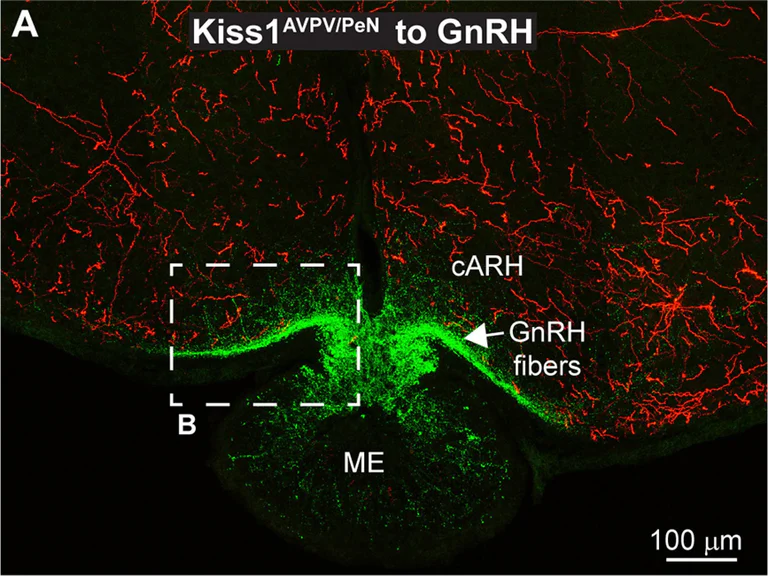 Immunohistochemistry (Frozen sections) - Anti-mCherry antibody (AB167453)