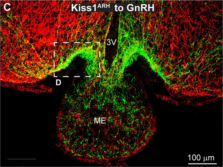 Immunohistochemistry (Frozen sections) - Anti-mCherry antibody (AB167453)