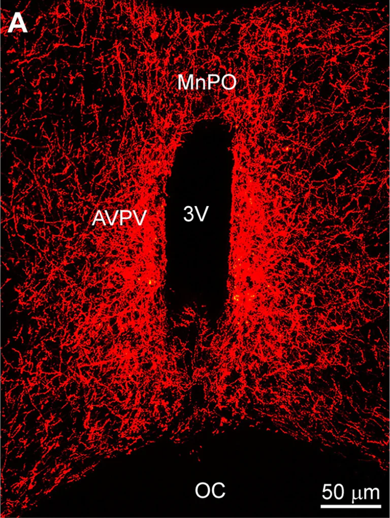 Immunohistochemistry (Frozen sections) - Anti-mCherry antibody (AB167453)