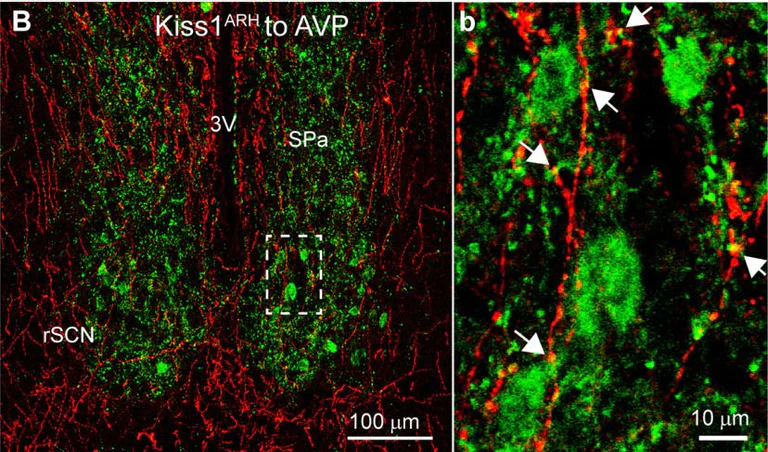 Immunohistochemistry (Frozen sections) - Anti-mCherry antibody (AB167453)