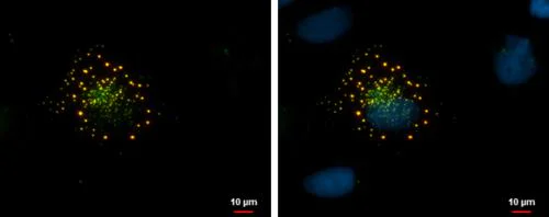 Immunocytochemistry/ Immunofluorescence - Anti-mCherry antibody (AB183628)