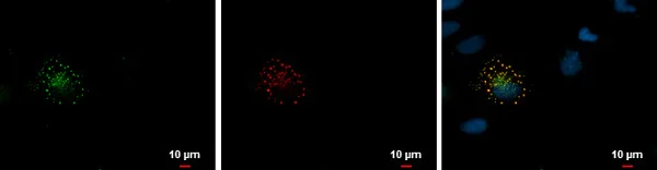 Immunocytochemistry/ Immunofluorescence - Anti-mCherry antibody (AB183628)