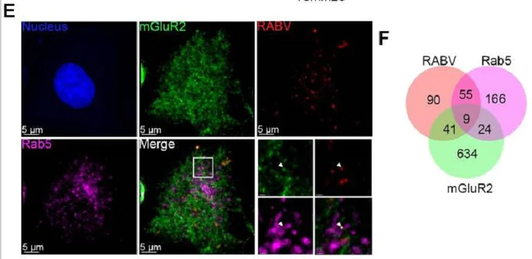 Immunocytochemistry/ Immunofluorescence - Anti-mCherry antibody (AB183628)