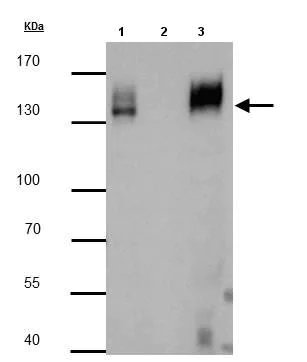 Immunoprecipitation - Anti-mCherry antibody (AB183628)