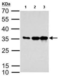Western blot - Anti-mCherry antibody (AB183628)