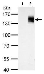 Western blot - Anti-mCherry antibody (AB183628)