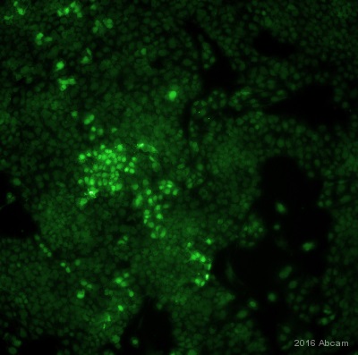 Immunocytochemistry/ Immunofluorescence - Anti-mCherry antibody (AB205402), expandable thumbnail