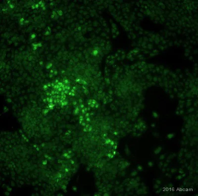 Immunocytochemistry/ Immunofluorescence - Anti-mCherry antibody (AB205402)