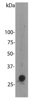 Western blot - Anti-mCherry antibody (AB205402), expandable thumbnail
