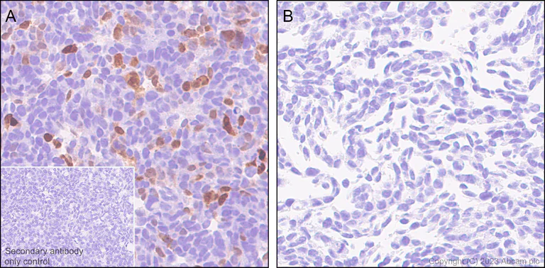 Immunohistochemistry (Formalin/PFA-fixed paraffin-embedded sections) - Anti-mCherry antibody [EPR20579] (AB213511)