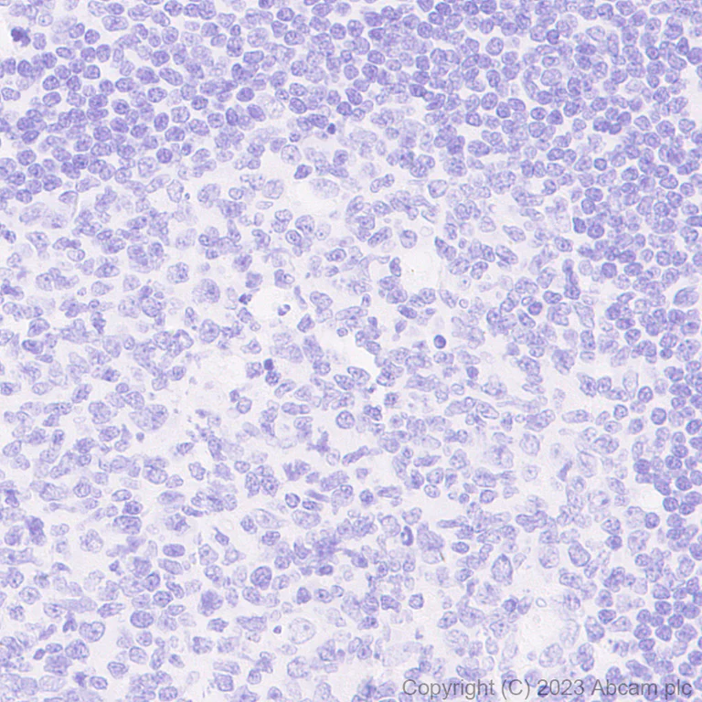 Immunohistochemistry (Formalin/PFA-fixed paraffin-embedded sections) - Anti-mCherry antibody [EPR20579] (AB213511)