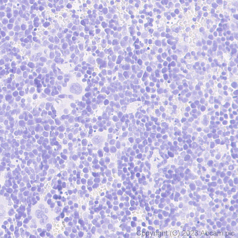 Immunohistochemistry (Formalin/PFA-fixed paraffin-embedded sections) - Anti-mCherry antibody [EPR20579] (AB213511)