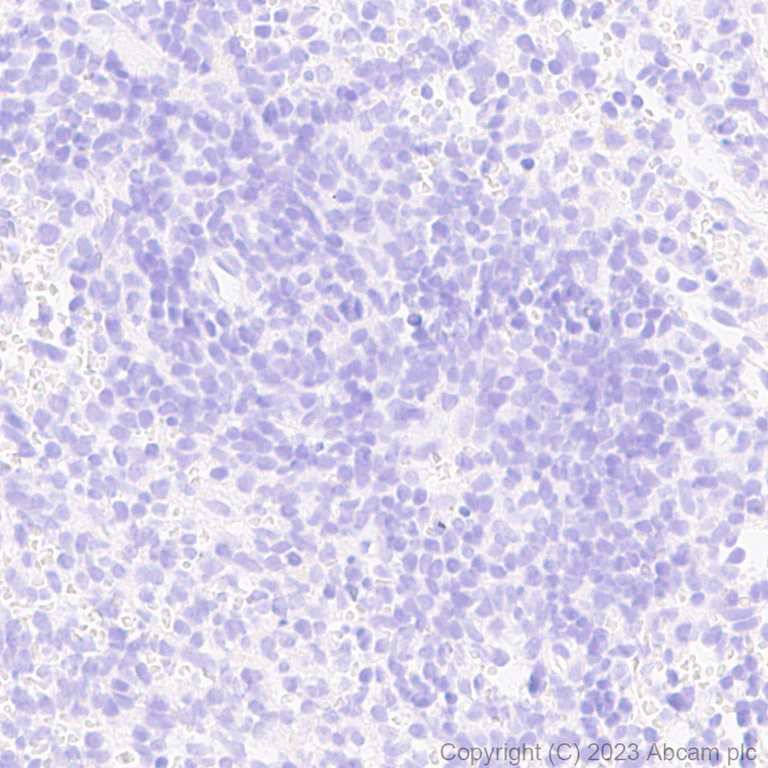Immunohistochemistry (Formalin/PFA-fixed paraffin-embedded sections) - Anti-mCherry antibody [EPR20579] (AB213511)