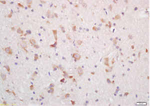Immunohistochemistry (Formalin/PFA-fixed paraffin-embedded sections) - Anti-MCHR-1 antibody (AB217849)