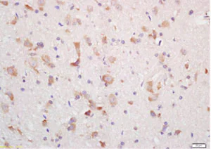 Immunohistochemistry (Formalin/PFA-fixed paraffin-embedded sections) - Anti-MCHR-1 antibody (AB217849)