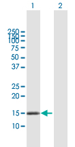 Western blot - Anti-MCJ antibody (AB167199)