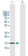 Western blot - Anti-MCJ antibody (AB167199)