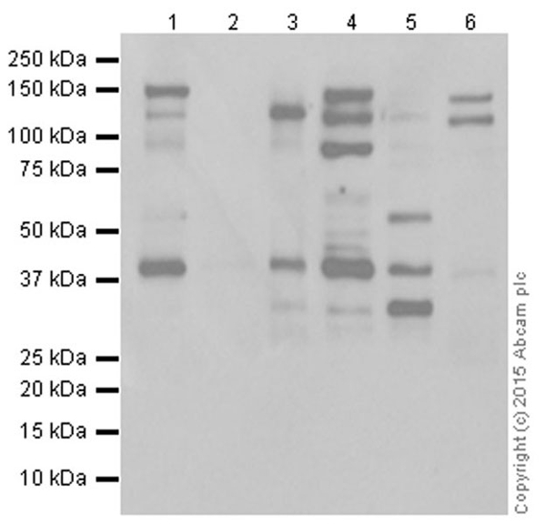 Western blot - Anti-MCL1 antibody [Y37] (AB32087), expandable thumbnail