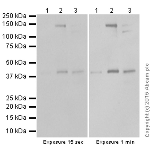 Western blot - Anti-MCL1 antibody [Y37] (AB32087), expandable thumbnail