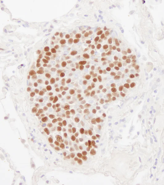 Immunohistochemistry (Formalin/PFA-fixed paraffin-embedded sections) - Anti-MCM2 antibody (AB4461)