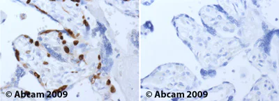 Immunohistochemistry (Formalin/PFA-fixed paraffin-embedded sections) - Anti-MCM2 antibody (AB4461)