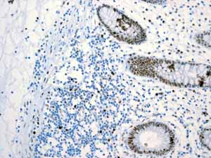 Immunohistochemistry (Formalin/PFA-fixed paraffin-embedded sections) - Anti-MCM2 antibody [EPR3727] - BSA and Azide free (ab248477), expandable thumbnail