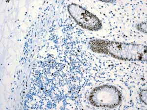 Immunohistochemistry (Formalin/PFA-fixed paraffin-embedded sections) - Anti-MCM2 antibody [EPR3727] - BSA and Azide free (AB248477)