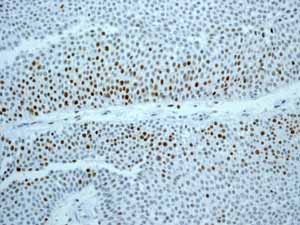 Immunohistochemistry (Formalin/PFA-fixed paraffin-embedded sections) - Anti-MCM2 antibody [EPR3727] - BSA and Azide free (ab248477), expandable thumbnail