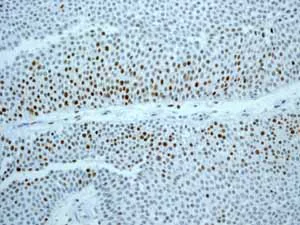 Immunohistochemistry (Formalin/PFA-fixed paraffin-embedded sections) - Anti-MCM2 antibody [EPR3727] - BSA and Azide free (AB248477)