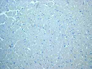 Immunohistochemistry (Formalin/PFA-fixed paraffin-embedded sections) - Anti-MCM2 antibody [EPR3727] - BSA and Azide free (ab248477), expandable thumbnail