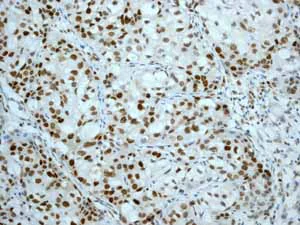 Immunohistochemistry (Formalin/PFA-fixed paraffin-embedded sections) - Anti-MCM2 antibody [EPR3727] - BSA and Azide free (AB248477)