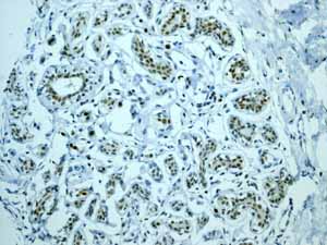 Immunohistochemistry (Formalin/PFA-fixed paraffin-embedded sections) - Anti-MCM2 antibody [EPR3727] - BSA and Azide free (ab248477), expandable thumbnail