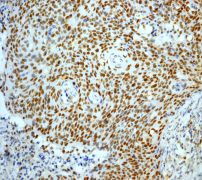 Immunohistochemistry (Formalin/PFA-fixed paraffin-embedded sections) - Anti-MCM2 antibody [EPR3727] - BSA and Azide free (AB248477), expandable thumbnail