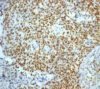 Immunohistochemistry (Formalin/PFA-fixed paraffin-embedded sections) - Anti-MCM2 antibody [EPR3727] - BSA and Azide free (AB248477)