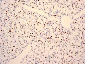 Immunohistochemistry (Formalin/PFA-fixed paraffin-embedded sections) - Anti-MCM2 antibody [EPR3727] - BSA and Azide free (ab248477), expandable thumbnail