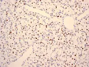 Immunohistochemistry (Formalin/PFA-fixed paraffin-embedded sections) - Anti-MCM2 antibody [EPR3727] - BSA and Azide free (AB248477)