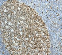 Immunohistochemistry (Formalin/PFA-fixed paraffin-embedded sections) - Anti-MCM2 antibody [EPR3727] - BSA and Azide free (AB248477), expandable thumbnail