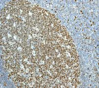 Immunohistochemistry (Formalin/PFA-fixed paraffin-embedded sections) - Anti-MCM2 antibody [EPR3727] - BSA and Azide free (AB248477)