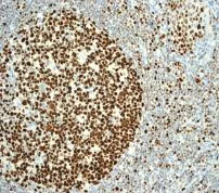 Immunohistochemistry (Formalin/PFA-fixed paraffin-embedded sections) - Anti-MCM2 antibody [EPR4120] (AB108935)