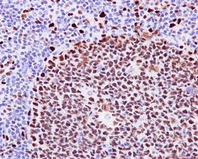 Immunohistochemistry (Formalin/PFA-fixed paraffin-embedded sections) - Anti-MCM2 antibody [EPR4120] (AB108935)