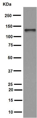 Western blot - Anti-MCM2 antibody [EPR4120] (AB108935)