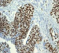 Immunohistochemistry (Formalin/PFA-fixed paraffin-embedded sections) - Anti-MCM2 antibody [EPR4120] - BSA and Azide free (AB226044)