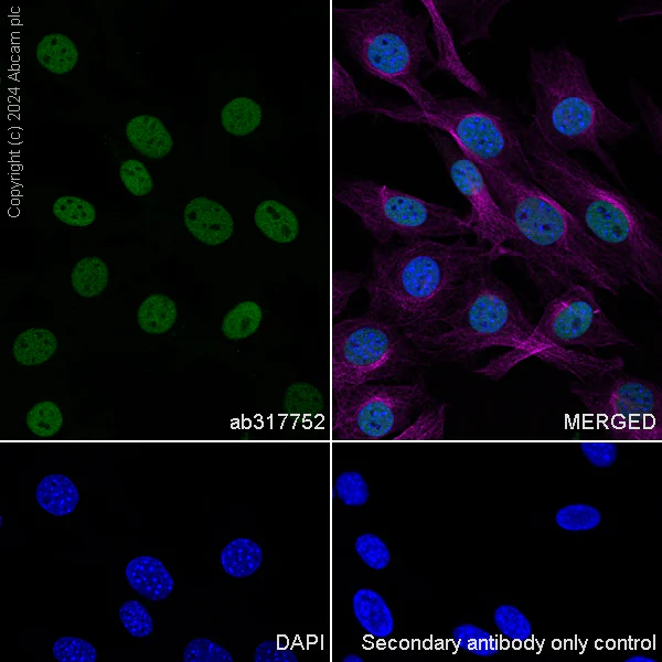 Immunocytochemistry/ Immunofluorescence - Anti-MCM2 antibody [RM1146] (AB317752)